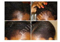 Herbal hair growth oil